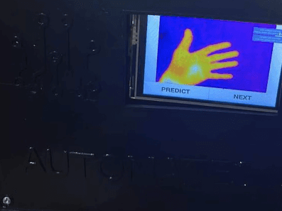 Integrating Flir One Pro with RPI for YOLOv7 Worm & Eggs Detection